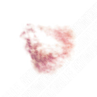 Hard Impact Bruise