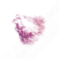 Hard Impact Bruise