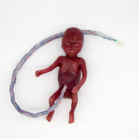 Baby Rob Premature