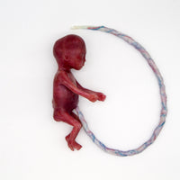 Baby Rob Premature