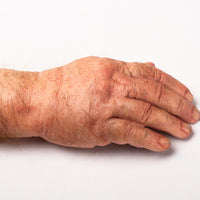 SEVERED AND BROKEN (2)