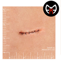 Stitched Wound