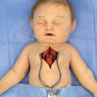Baby Jules 3-Month-Old Surgery