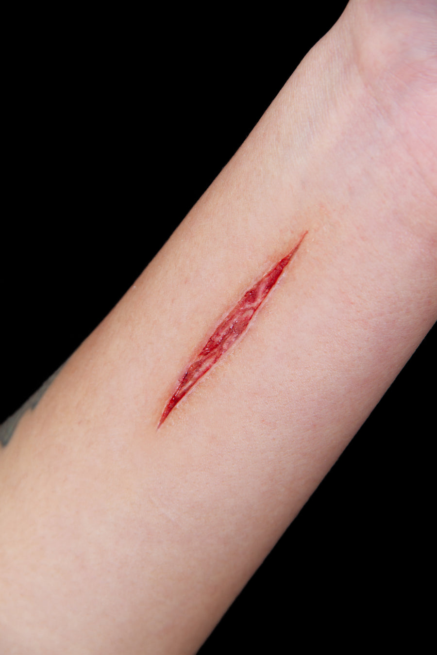 Slice Wound