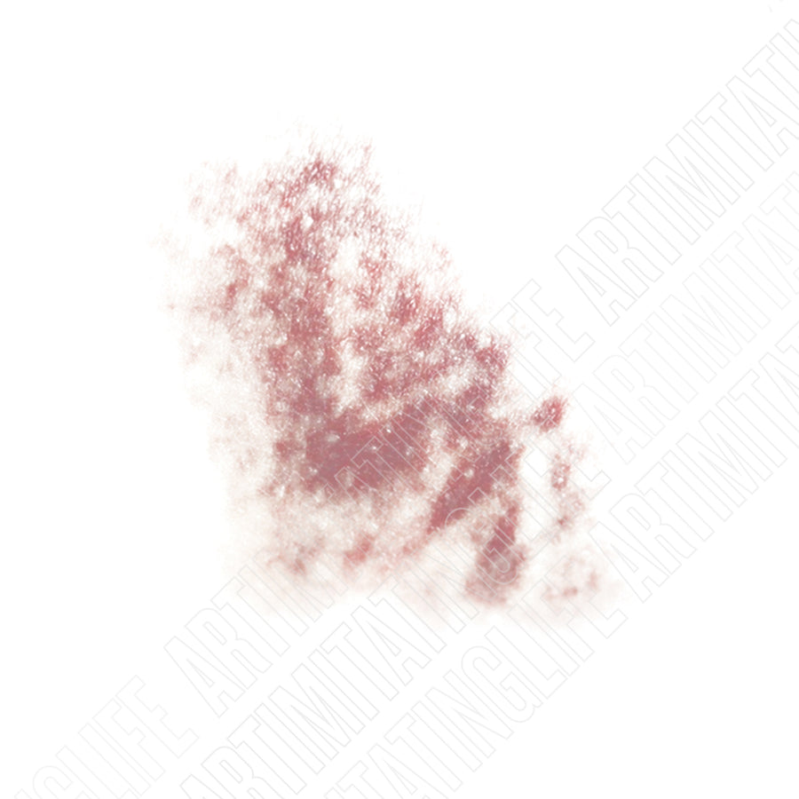 Mottled Bruise