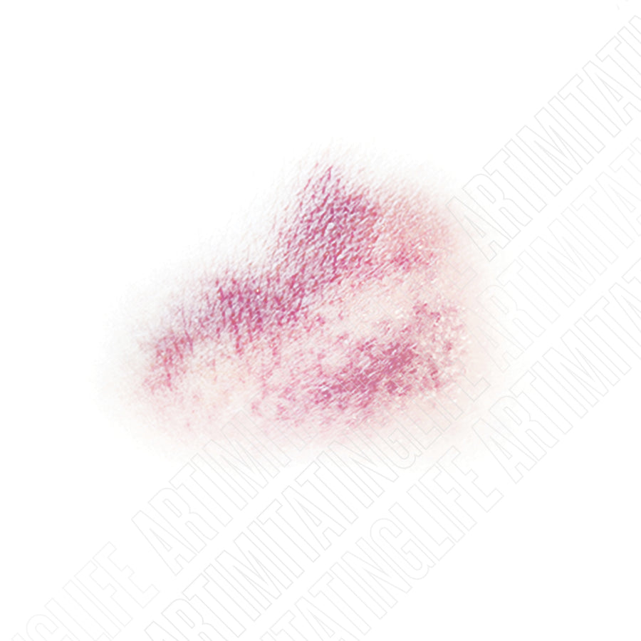 Two-Tone Bruise