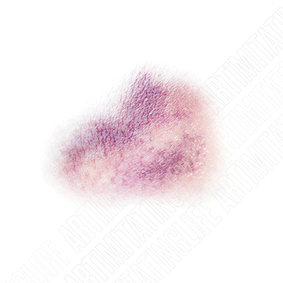 Two-Tone Bruise