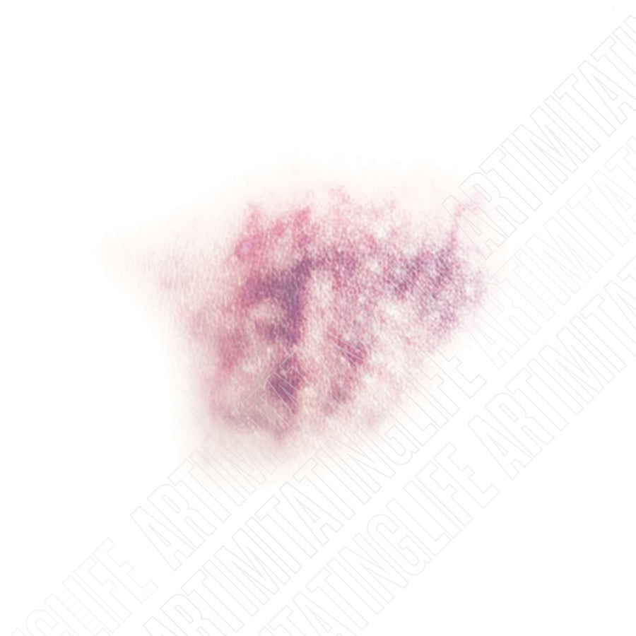 Uneven Bruise