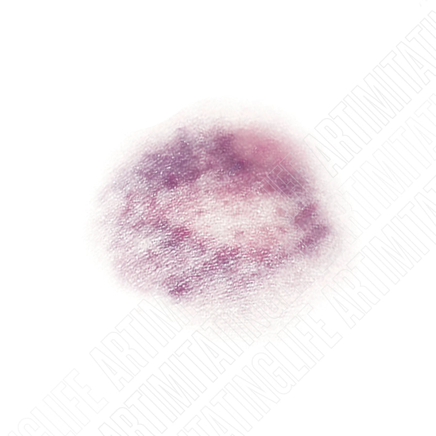 Spotted Bruise