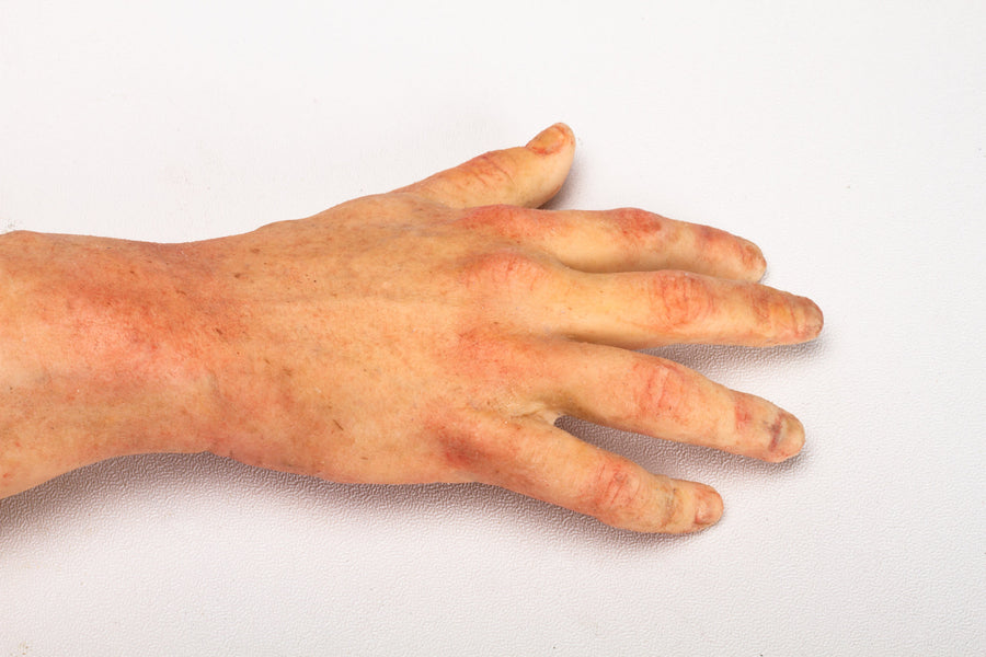 SEVERED RIGHT (2)