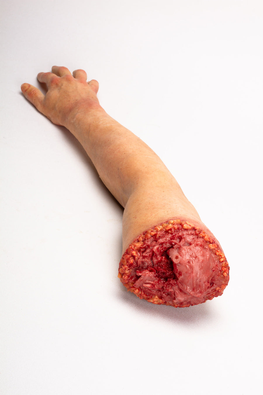 SEVERED RIGHT (3)