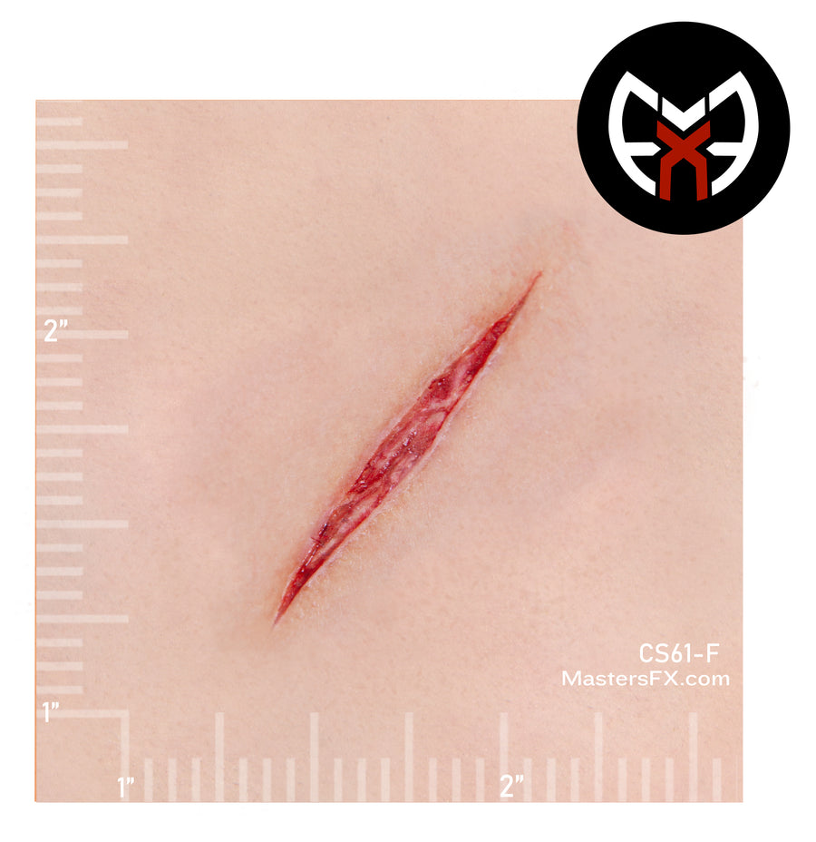 Slice Wound